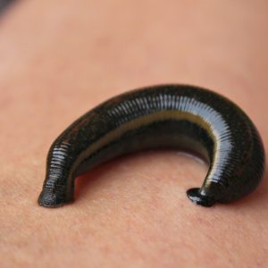 A leech on human skin