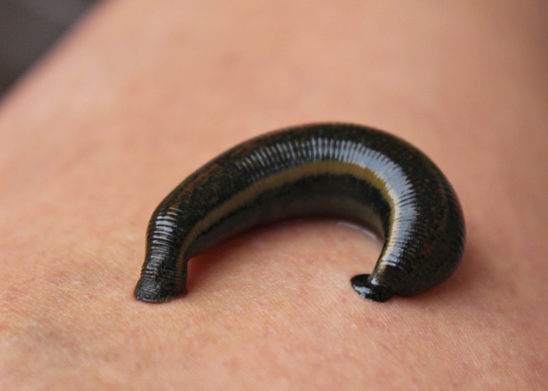 A leech on human skin