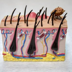 Medical model of a section of the scalp and follicles with scabies specimen of scalp section and follicles with scabies